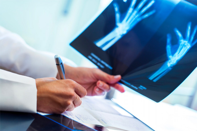 radiographie